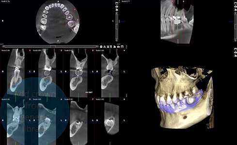 3D cone beam scans of face and teeth