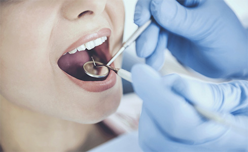 Closeup of patient receiving dental checkup