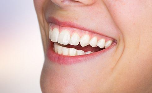 Closeup of healthy smile after gum recontouring