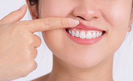 Woman showing her gums