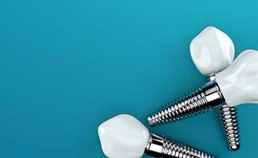 Three dental implants in front of a dark blue background