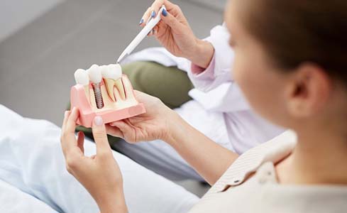 Dentist showing a model of a dental implant to a patient