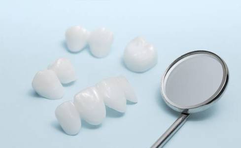 dental crowns and restorations