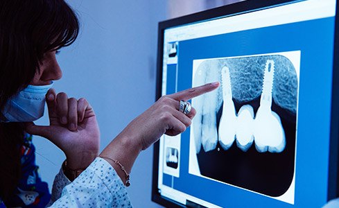 Dentist pointing to digital x-rays