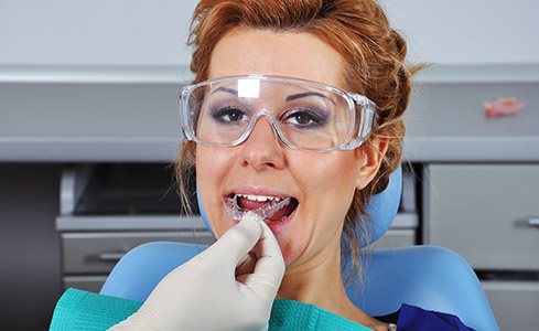 Dentist placing occlusal splint