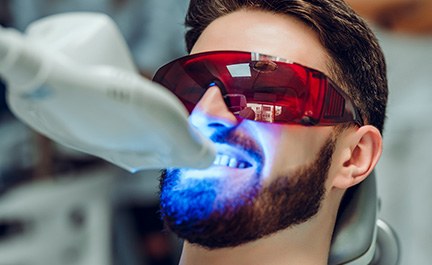 Different teeth whitening options cost different amounts