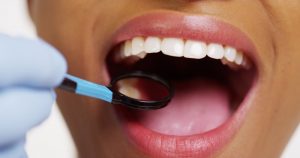 woman smiling undergoing dental checkup