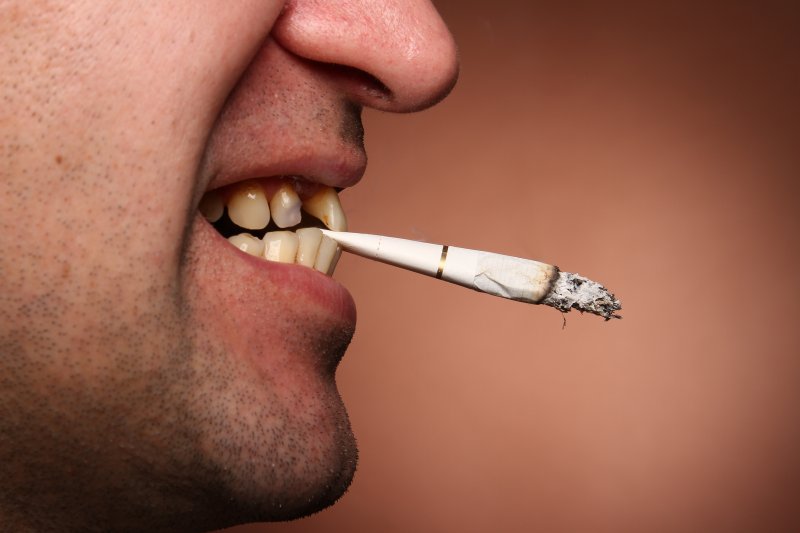 man holding cigarette by the teeth in Long Island City