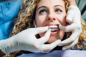 a woman getting Invisalign treatment from her dentist