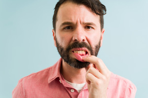 Bearded man pulling down lip to show gums